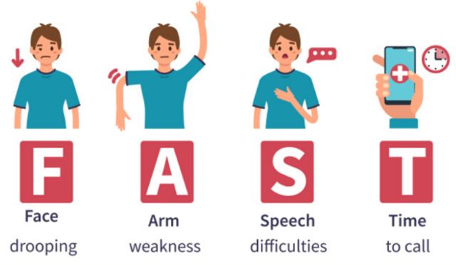 Accidente cerebrovascular: ¿qué es la regla FAST y cómo puede salvar tu vida?