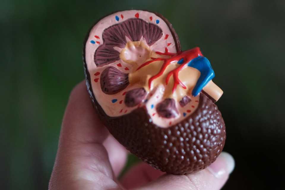 1 de cada 10 adultos en Perú padece una enfermedad renal crónica