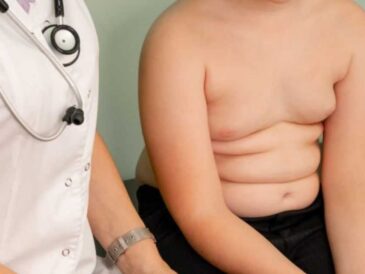 Obesidad en el Perú: una amenaza creciente