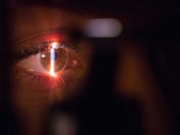 Glaucoma en Perú: la enfermedad silenciosa que causa ceguera