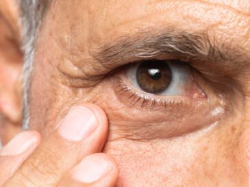 Pantallas y ojo seco: por qué el 45% de peruanos no rinde