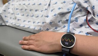 Galaxy Watch predice desmayos con IA en estudio clínico