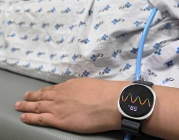 Galaxy Watch predice desmayos con IA en estudio clínico