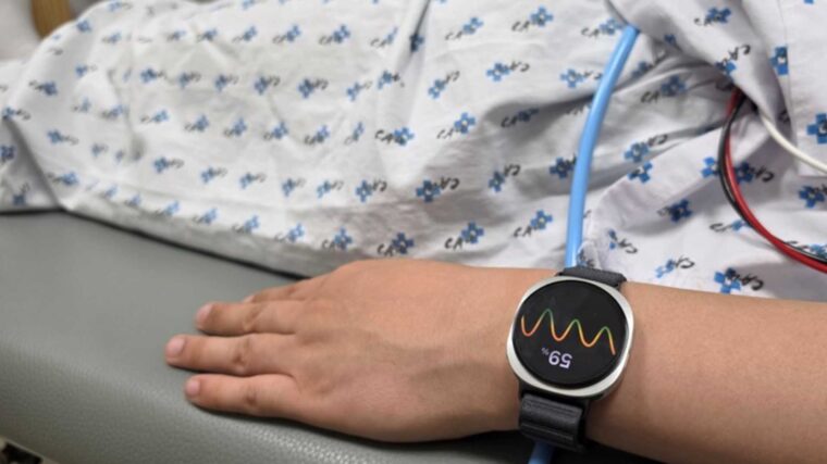 Galaxy Watch predice desmayos con IA en estudio clínico